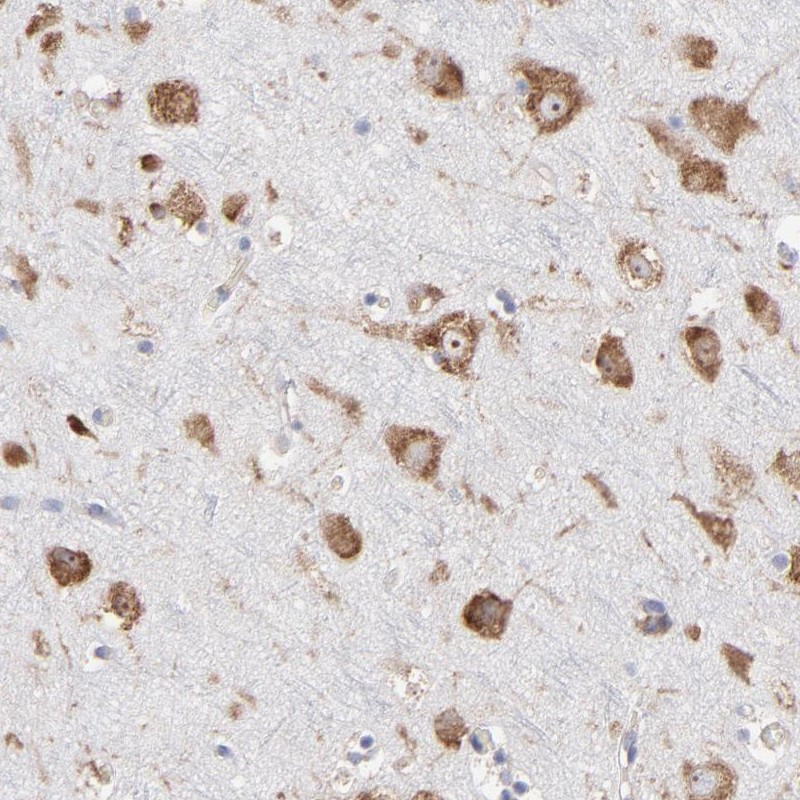 Atlas Antibodies Anti-RPL3 Antibody
