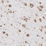 Atlas Antibodies Anti-RPL3 Antibody