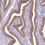 Atlas Antibodies Anti-RPL28 Antibody