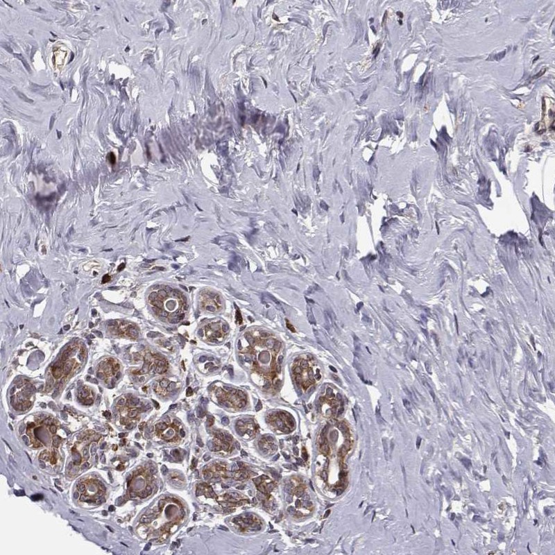 Atlas Antibodies Anti-RPL31 Antibody