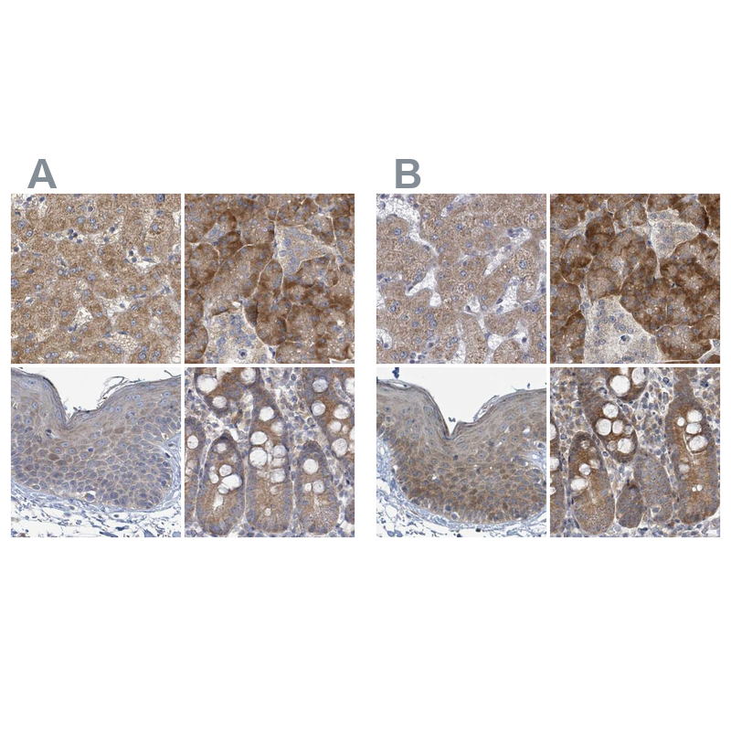Atlas Antibodies Anti-RPL32 Antibody