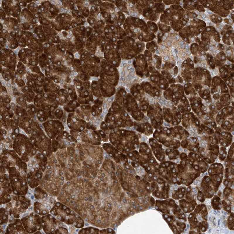 Atlas Antibodies Anti-RPL34 Antibody