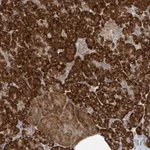 Atlas Antibodies Anti-RPL34 Antibody
