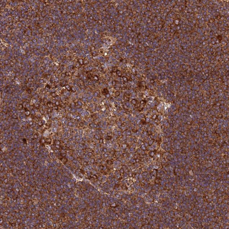 Atlas Antibodies Anti-RPL36 Antibody