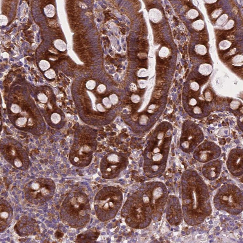 Atlas Antibodies Anti-RPL37A Antibody