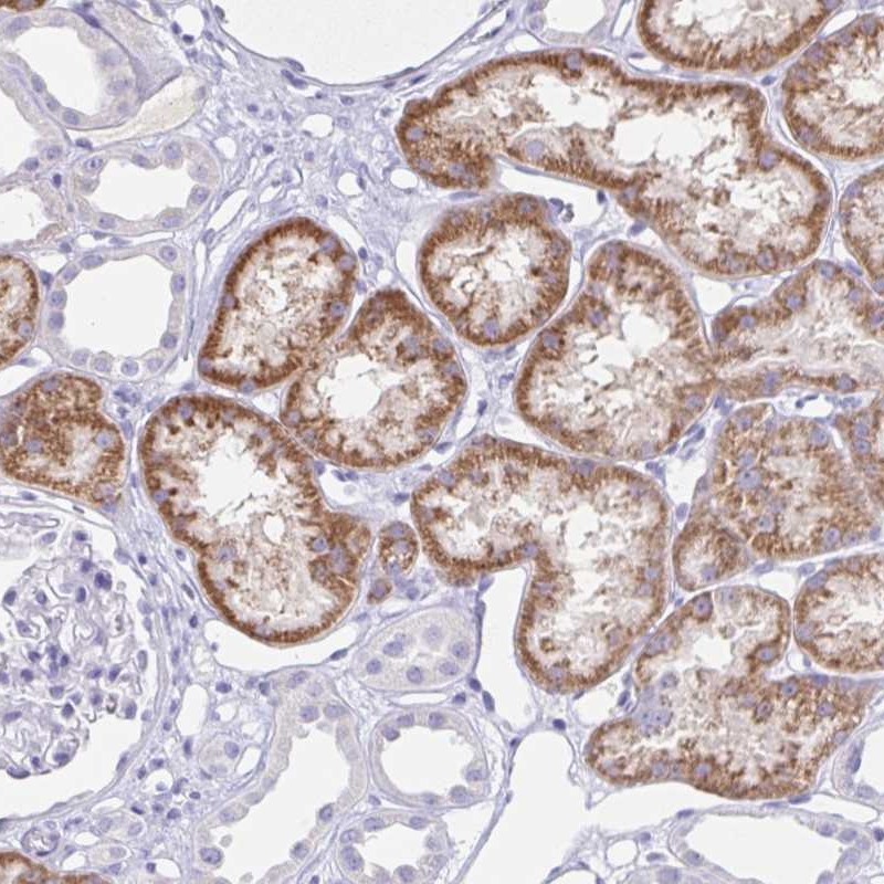 Atlas Antibodies Anti-RPL36A Antibody