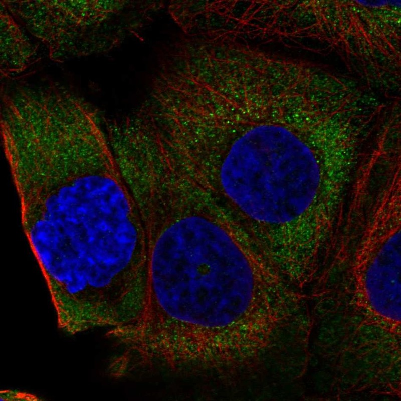 Atlas Antibodies Anti-RPL36A Antibody