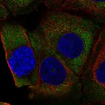 Atlas Antibodies Anti-RPL36A Antibody