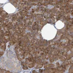 Atlas Antibodies Anti-RPL4 Antibody