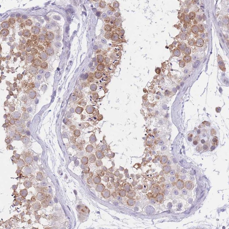 Atlas Antibodies Anti-RPL39L Antibody