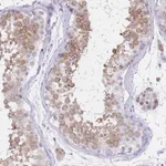 Atlas Antibodies Anti-RPL39L Antibody