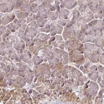 Atlas Antibodies Anti-RPL38 Antibody