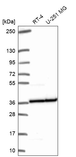Atlas Antibodies Anti-RPL5 Antibody