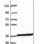 Atlas Antibodies Anti-RPL5 Antibody