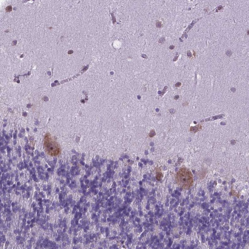 Atlas Antibodies Anti-RPL6 Antibody