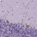 Atlas Antibodies Anti-RPL6 Antibody