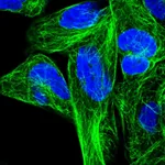 Atlas Antibodies Anti-RPL6 Antibody