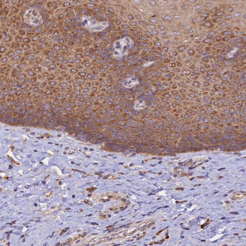 Atlas Antibodies Anti-RPL5 Antibody