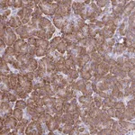 Atlas Antibodies Anti-RPL7 Antibody