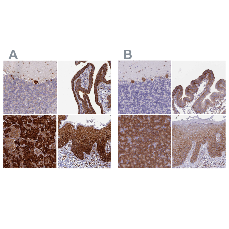 Atlas Antibodies Anti-RPL8 Antibody
