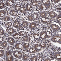 Atlas Antibodies Anti-RPLP0 Antibody
