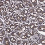 Atlas Antibodies Anti-RPLP0 Antibody