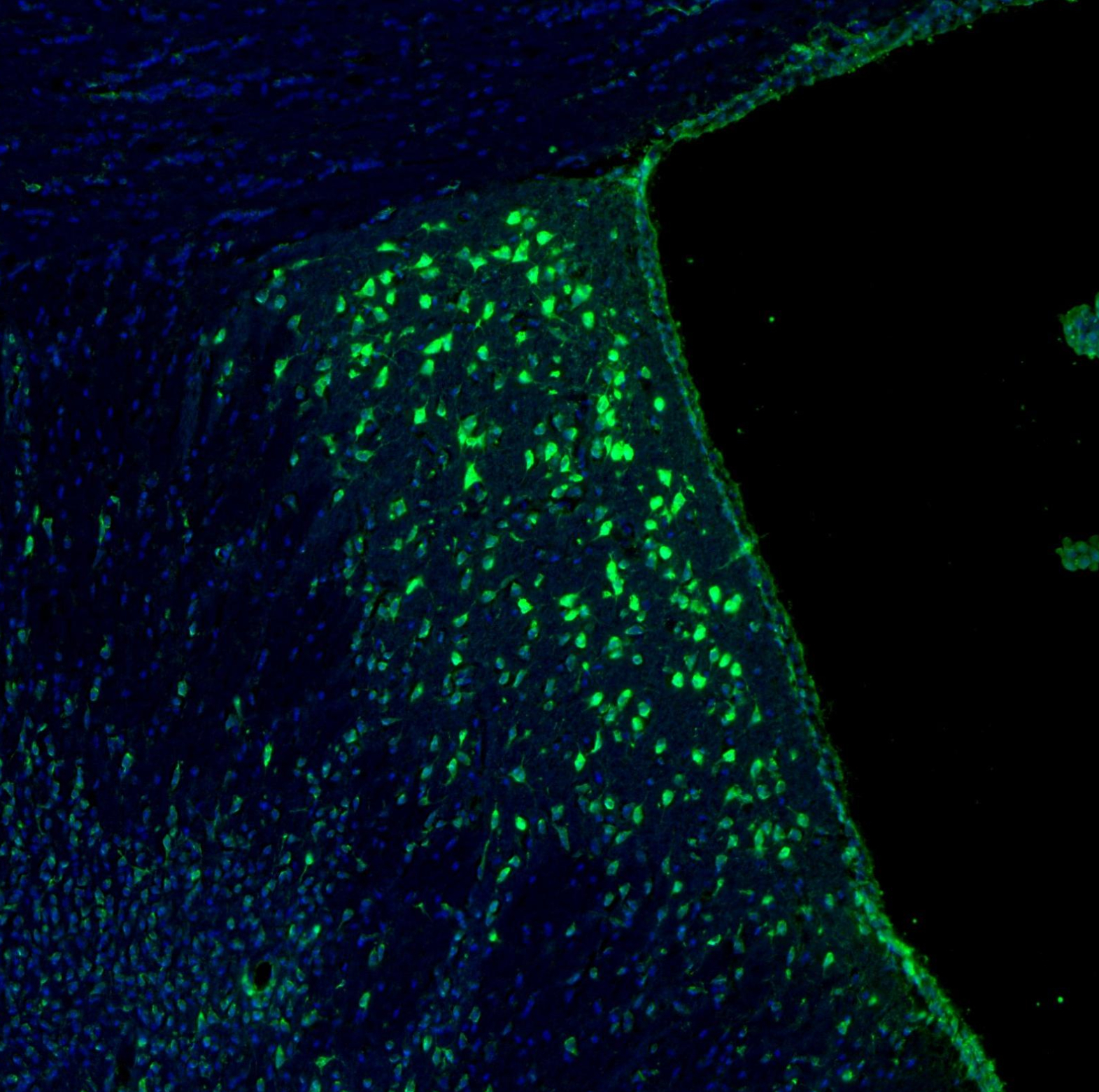 Atlas Antibodies Anti-RPL9 Antibody
