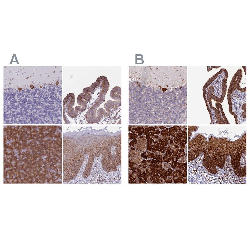 Atlas Antibodies Anti-RPL8 Antibody
