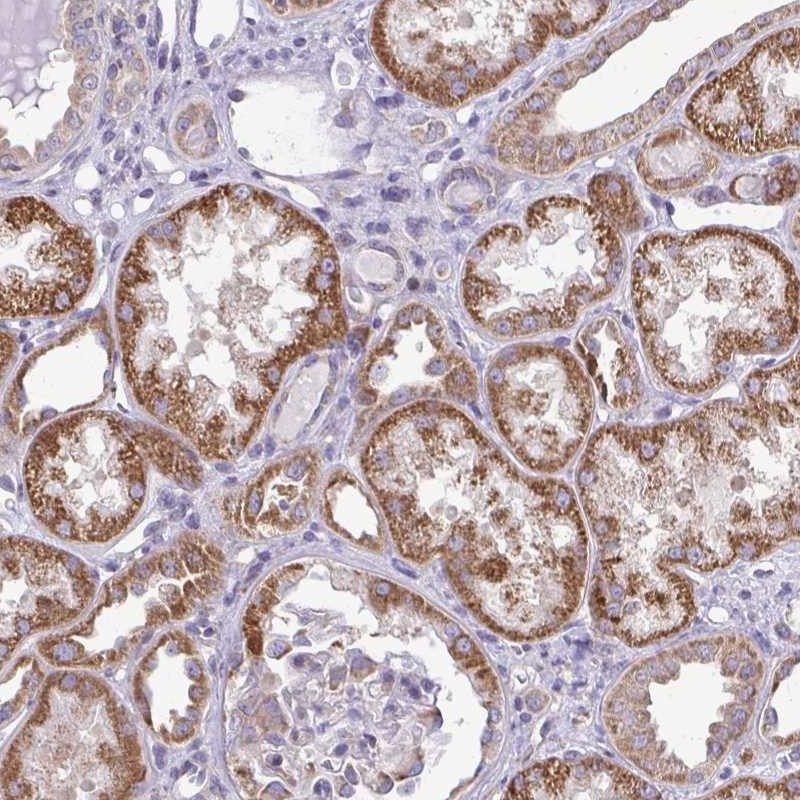 Atlas Antibodies Anti-RPLP2 Antibody