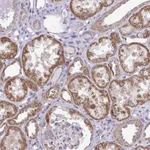 Atlas Antibodies Anti-RPLP2 Antibody