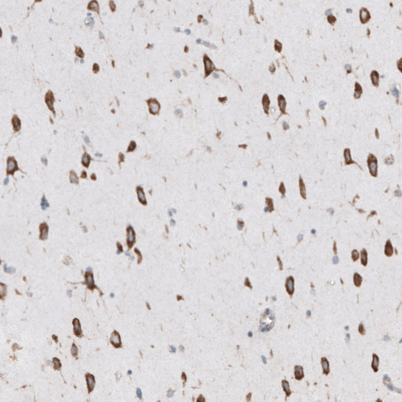 Atlas Antibodies Anti-RPLP1 Antibody