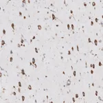 Atlas Antibodies Anti-RPLP1 Antibody