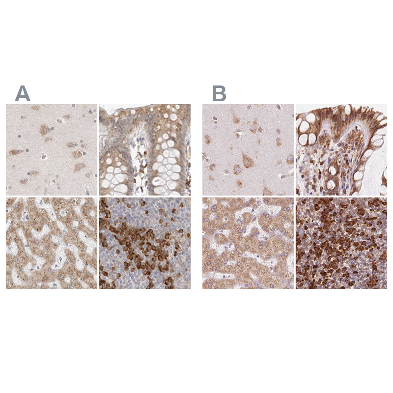 Atlas Antibodies Anti-RPN1 Antibody