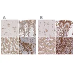 Atlas Antibodies Anti-RPN1 Antibody