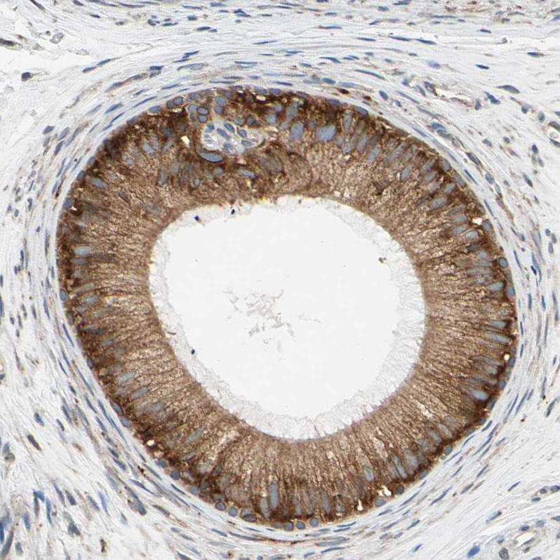Atlas Antibodies Anti-RPN2 Antibody