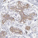 Atlas Antibodies Anti-RPLP0 Antibody