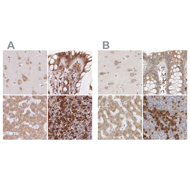 Atlas Antibodies Anti-RPN1 Antibody