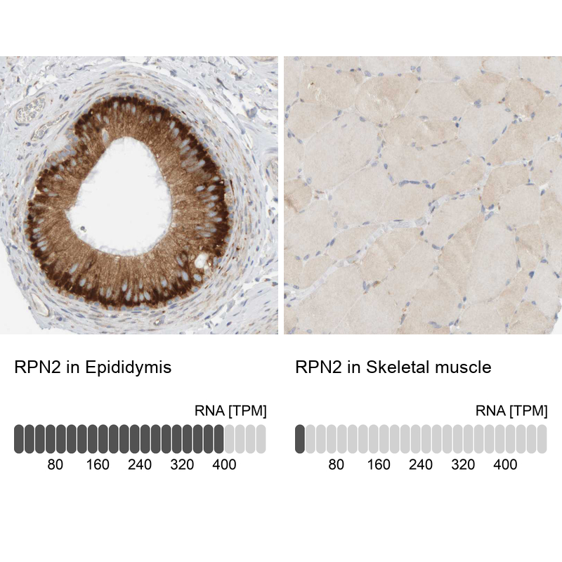 Atlas Antibodies Anti-RPN2 Antibody