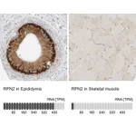 Atlas Antibodies Anti-RPN2 Antibody