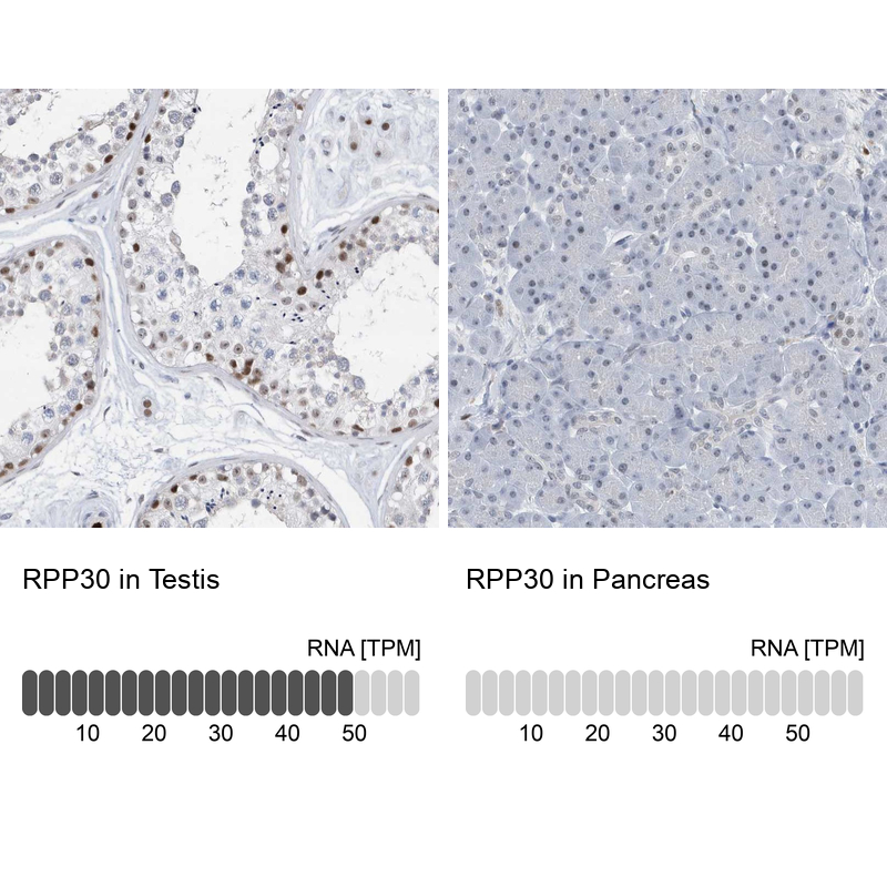 Atlas Antibodies Anti-RPP30 Antibody