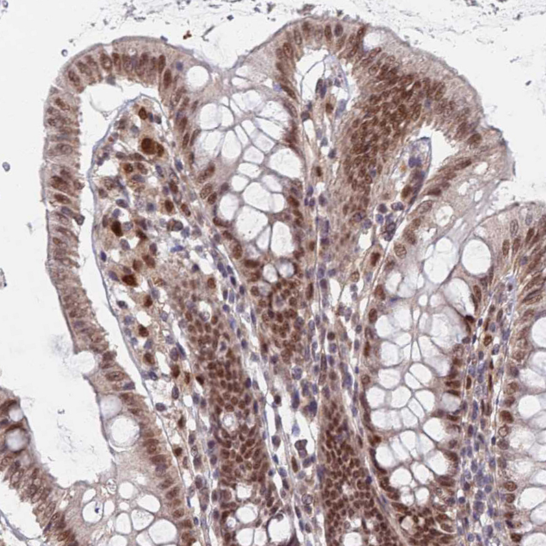 Atlas Antibodies Anti-RPP25 Antibody