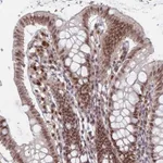Atlas Antibodies Anti-RPP25 Antibody