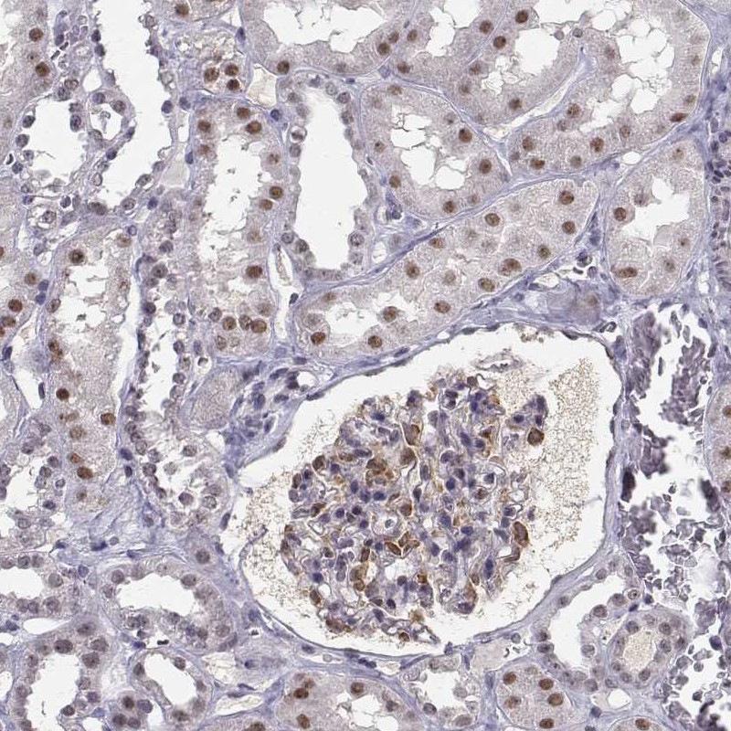 Atlas Antibodies Anti-RPP38 Antibody
