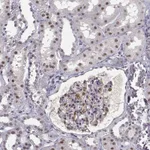 Atlas Antibodies Anti-RPP38 Antibody
