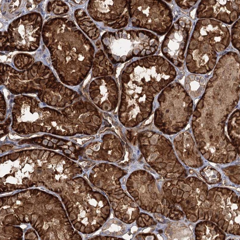 Atlas Antibodies Anti-RPP14 Antibody