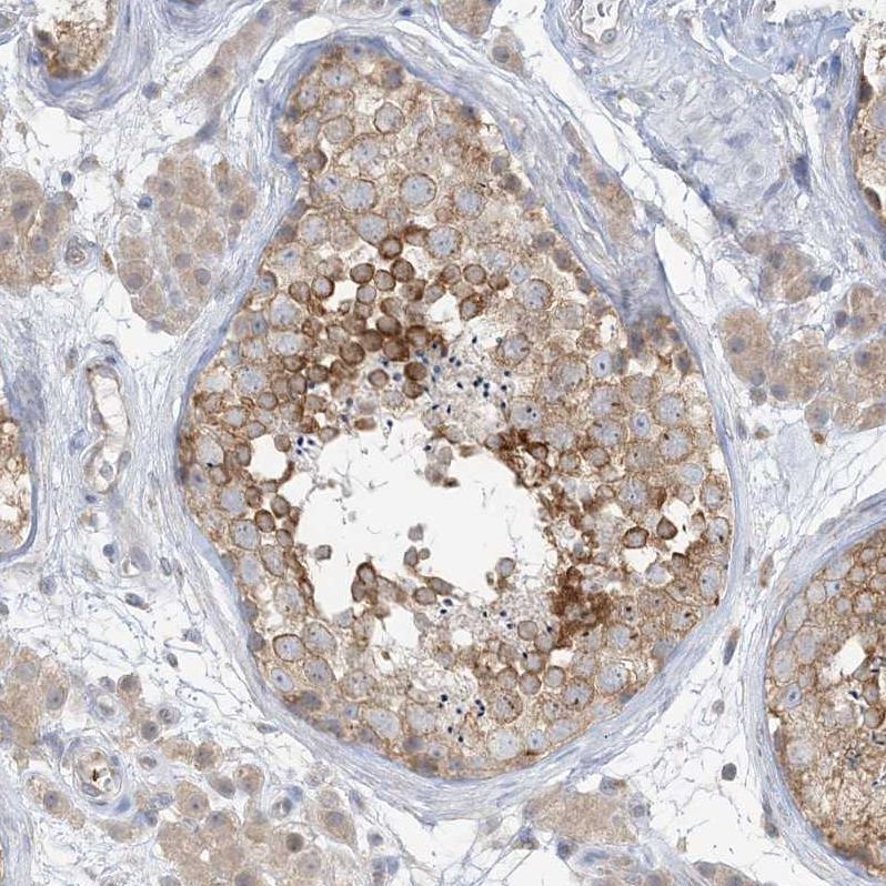 Atlas Antibodies Anti-RPP40 Antibody