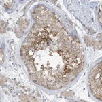 Atlas Antibodies Anti-RPP40 Antibody