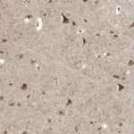 Atlas Antibodies Anti-RPP40 Antibody