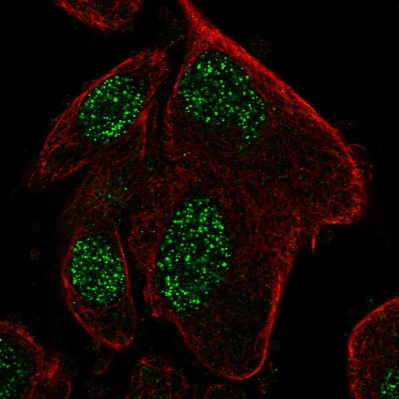Atlas Antibodies Anti-RPP25L Antibody