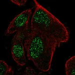 Atlas Antibodies Anti-RPP25L Antibody